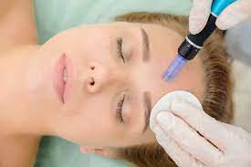 Curso dermapen para fisioterapeutas